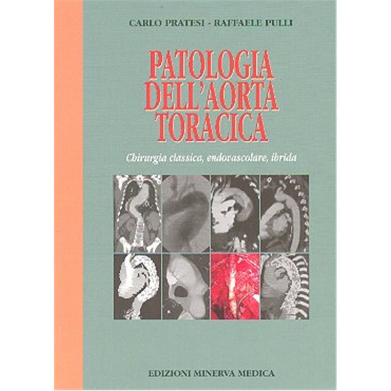 Patologia dell'aorta toracica - Chirurgia classica, endovascolare, ibrida